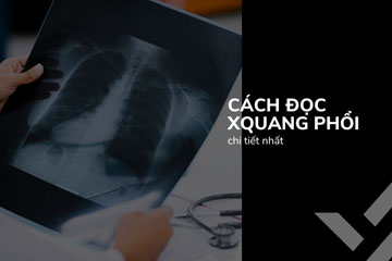 Hướng dẫn đọc X-quang xương khớp PDF chi tiết cho người mới bắt đầu