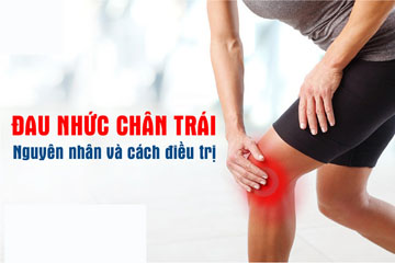 Đau nhức từ mông xuống bắp chân trái là bị gì và nên làm gì?