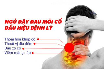 Ngủ dậy bị đau cổ: Cách chữa đau cổ khi ngủ sai tư thế