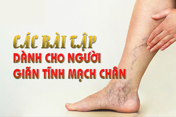 Cách xoa bóp chân tay bị giãn tĩnh mạch tốt cực kì